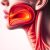 Angina: objawy, przyczyny i skuteczne metody leczenia
